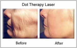 dot_therapy4-300x189