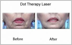 dot_therapy5-300x189